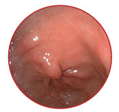 Video Endoscope System V7